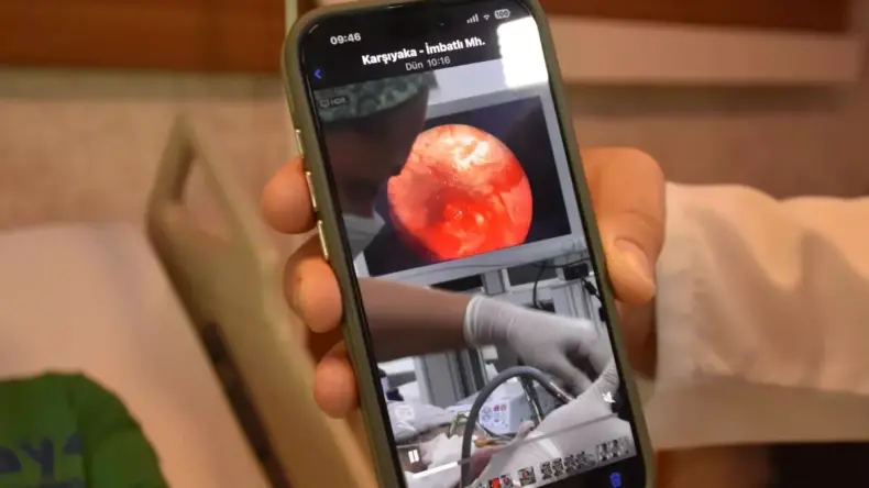 Diş İmplantı Akciğere Kaçtı